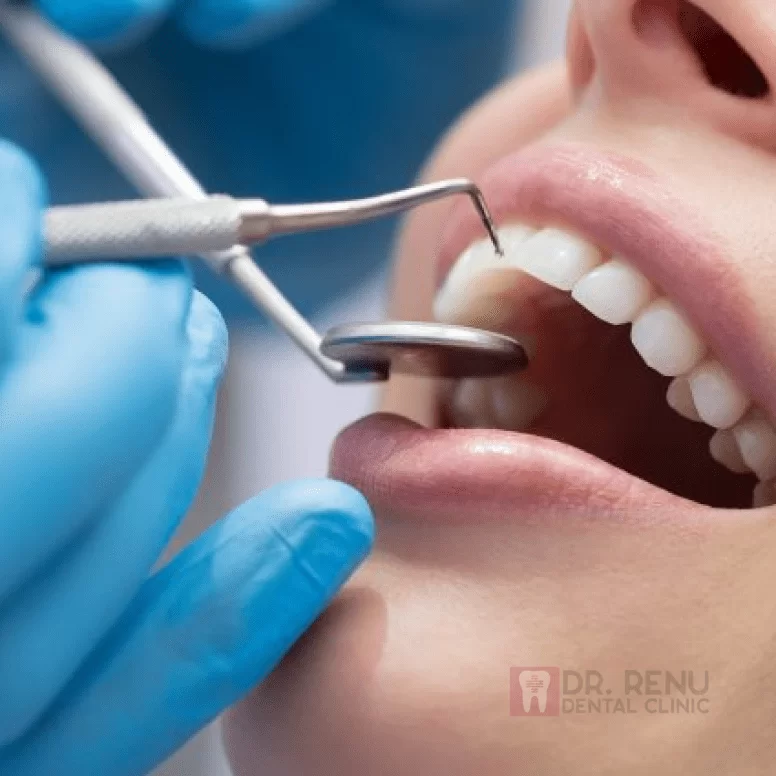 Affordable and Quality Dental Care: Best Dentists in Jaipur You Can Trust